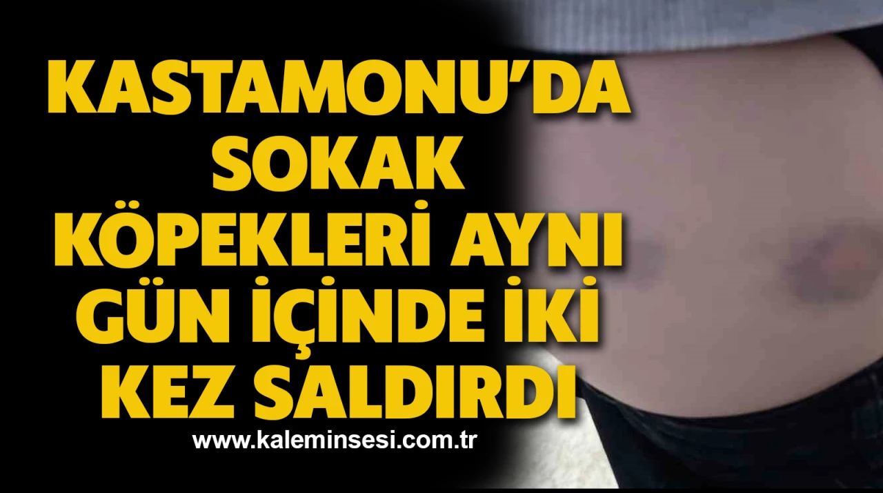Kastamonu’da sokak köpekleri aynı gün içinde iki kez saldırdı