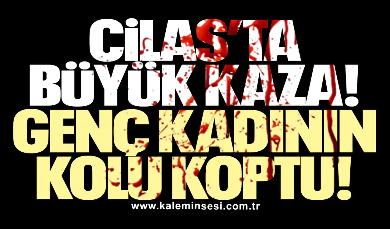 Cilas’ta büyük kaza! Genç kadının kolu koptu!